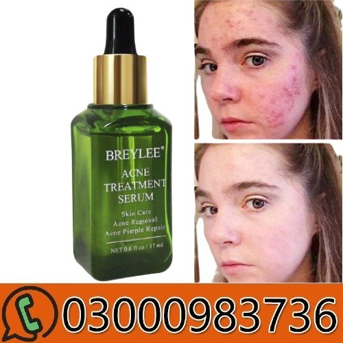 Breylee Acne Treatment Serum in Pakistan