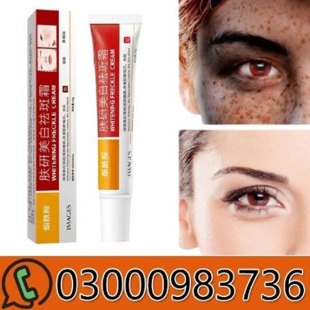 Facial Dark Spots Freckle Removing Cream In Pakistan